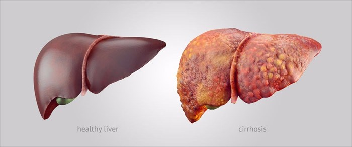 liver-inflammation-gut-and-gastroenterology