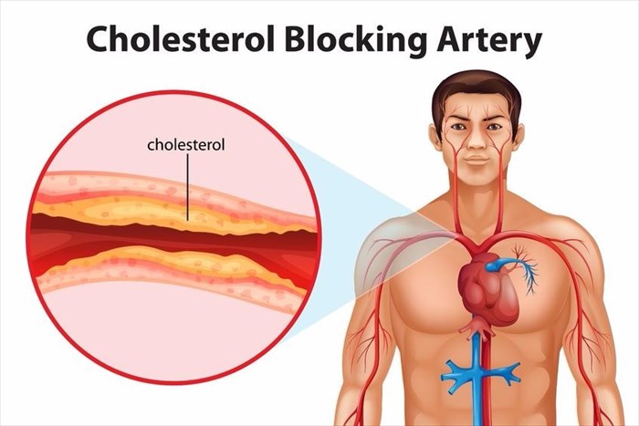 clitoromegaly steroids