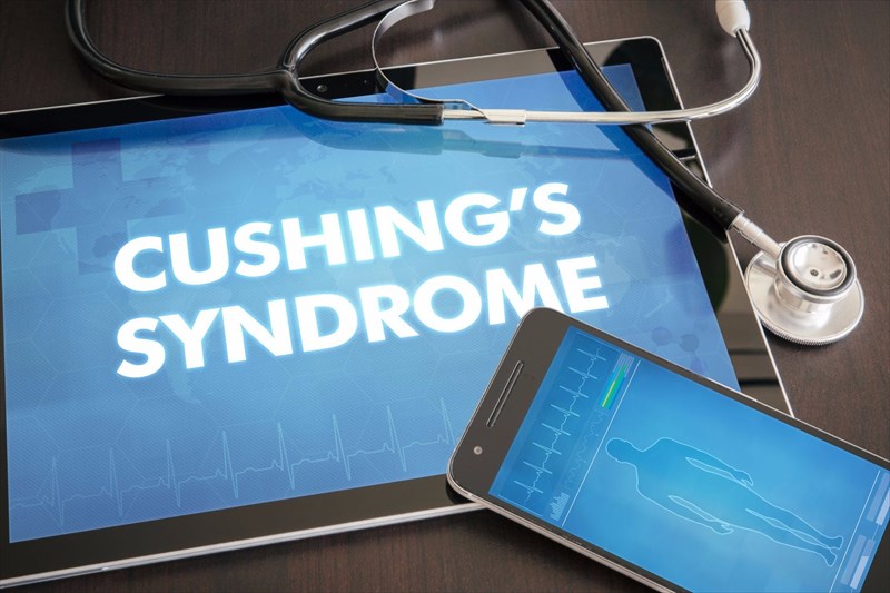 Defining Cushing's Syndrome, Symptoms And Treatment