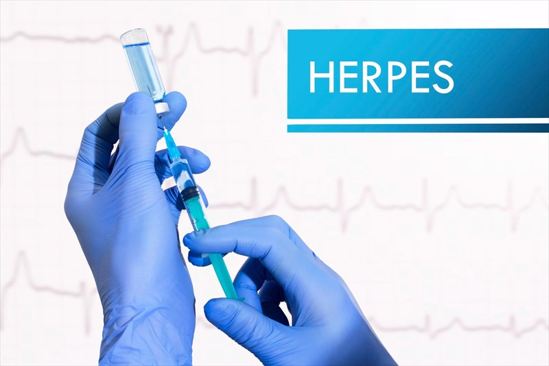 show pictures of genital herpes in women        
        <figure class=