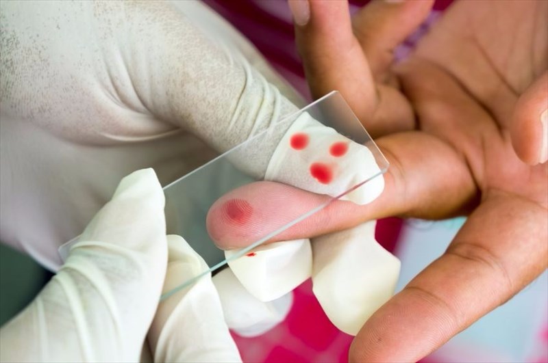 diagnosing-and-treating-malaria