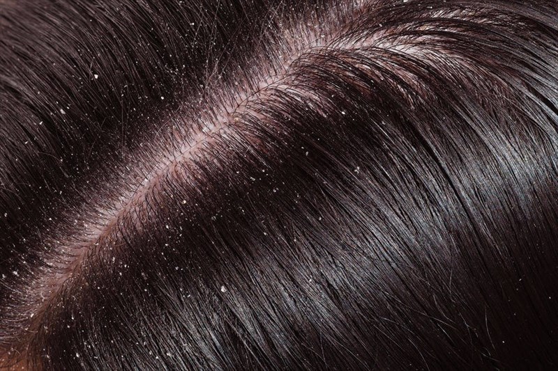 Can your hair and scalp also show signs of ill health