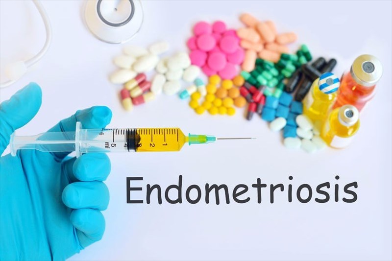 How Is Endometriosis Treated 8822