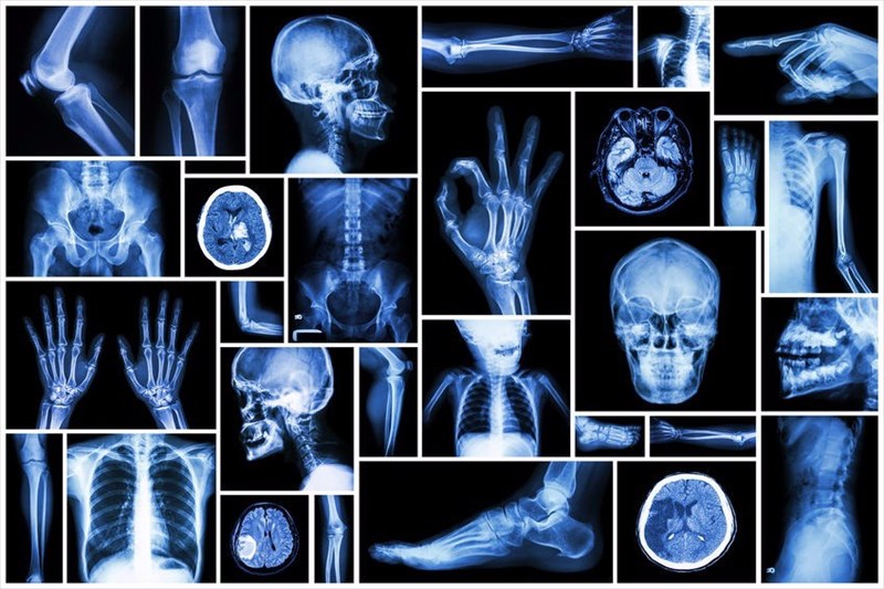 X Rays How They Work And What They Show