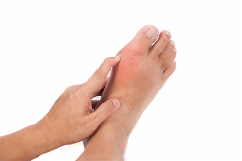 Signs And Symptoms Of Gout   800