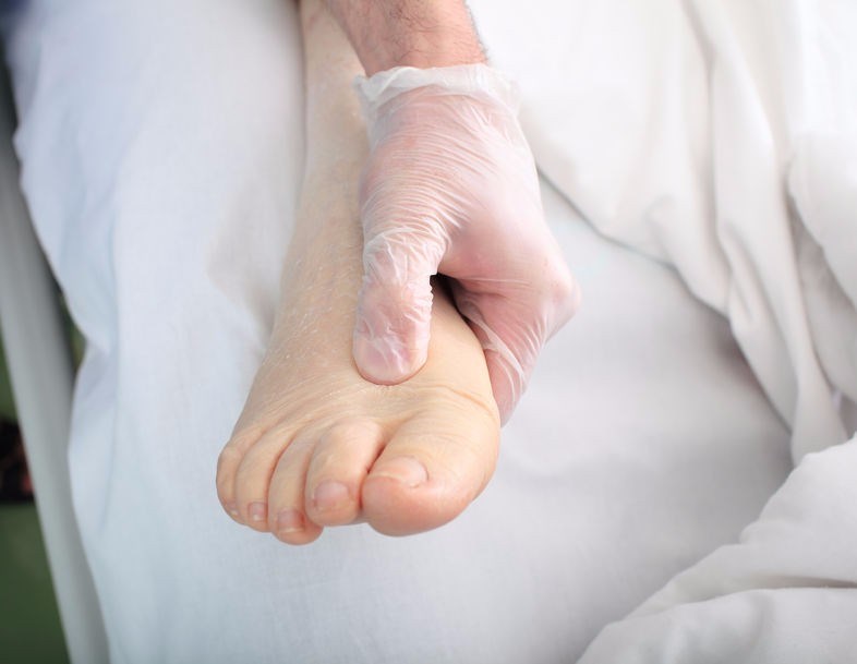 Oedema – Hot and Swollen Ankles and Feet - The Foot and Ankle Clinic