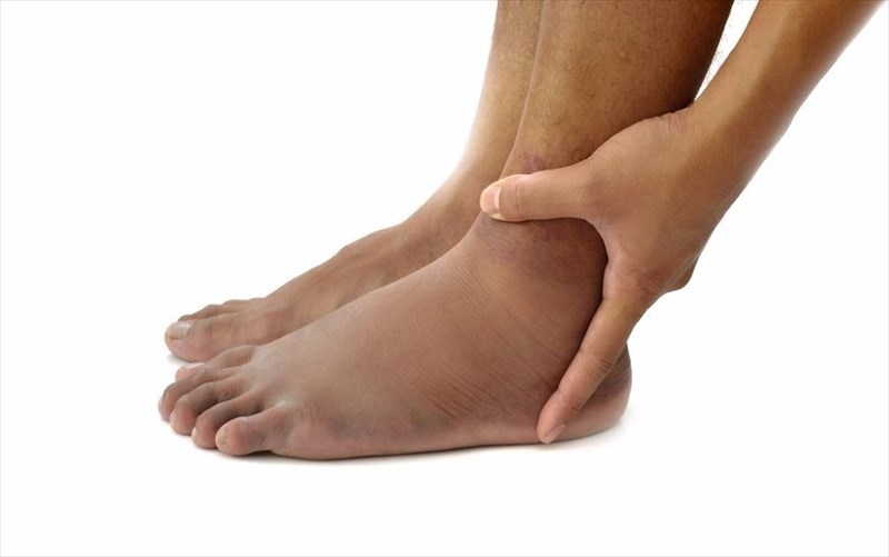 What Are The Complications Of Swollen Feet And Ankles