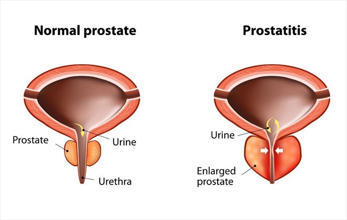 Why Do I Have A Constant Urge To Urinate?