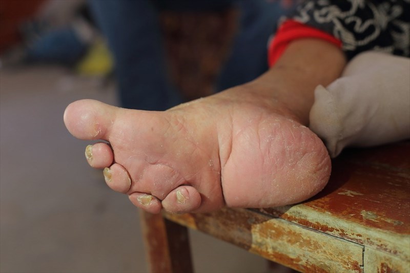 foot binding process step by step