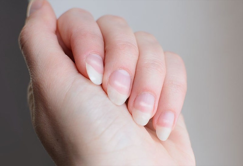 What your nails can tell you about your health