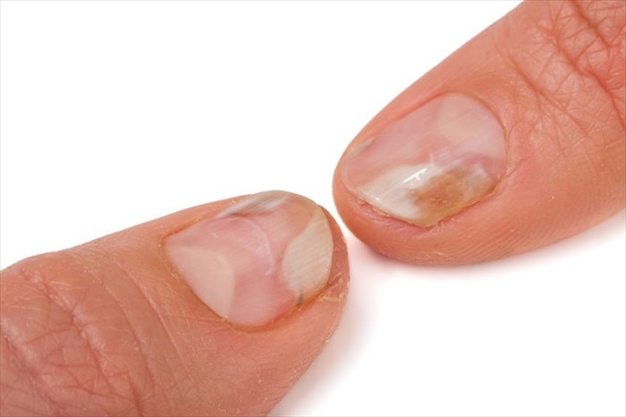 What Your Nails Can Tell You About Your Health