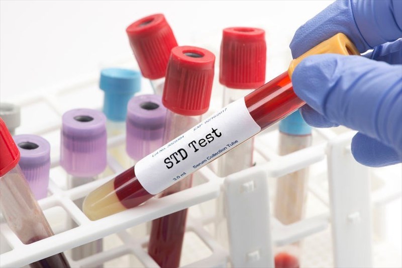 STD testing and at home STD test options