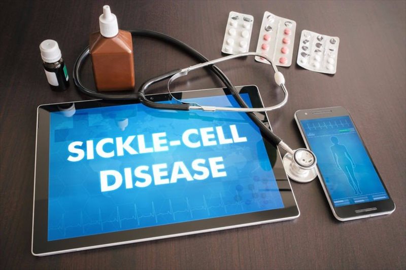 sickle cell symptoms and treatment