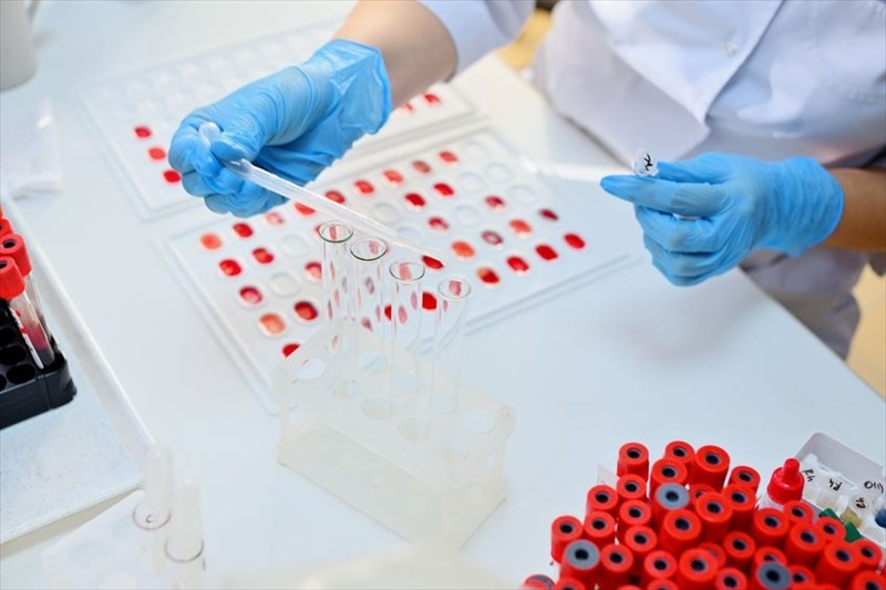 Blood Type Test Kit  Group A, B, O and Rhesus D