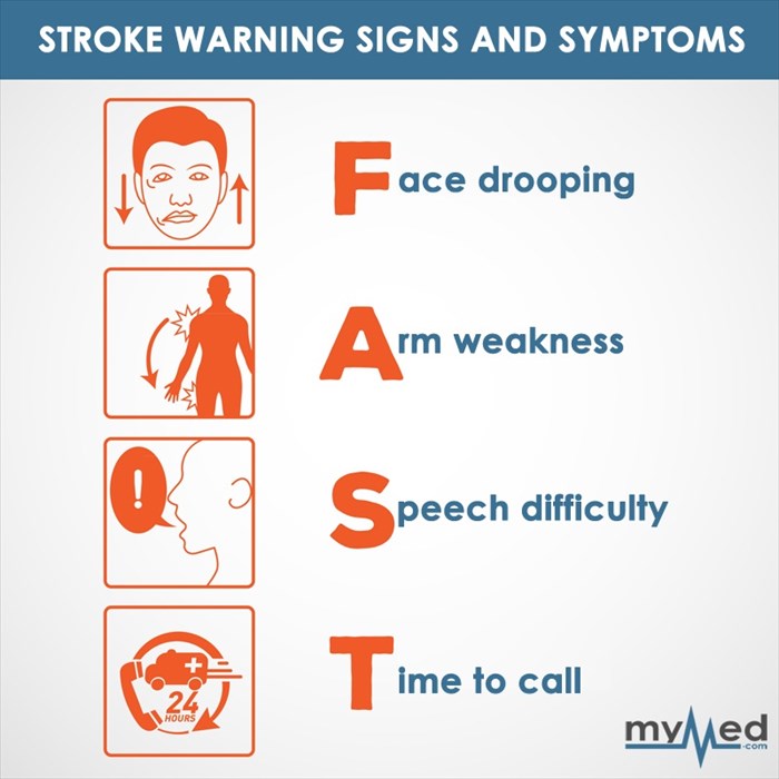 Stroke Signs and Symptoms