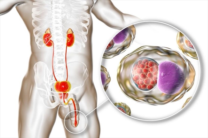 Chlamydia A Complete Guide To This Common Sti