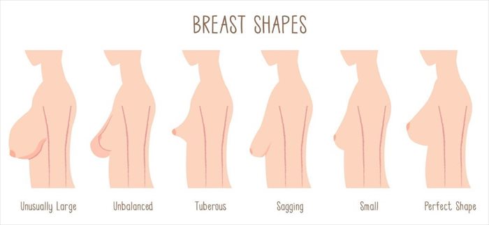 What's the Best Way to Lift Sagging Breasts?