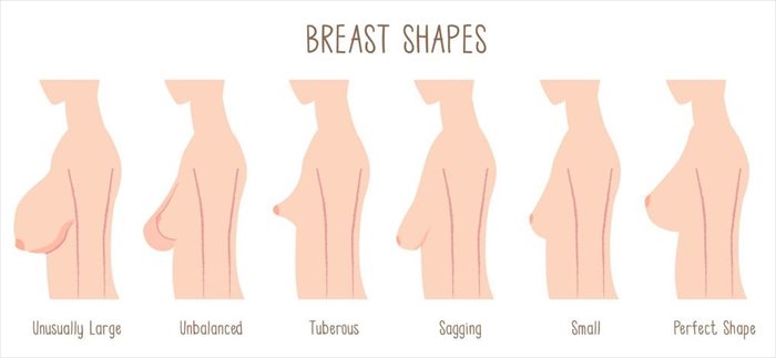 breast sag test